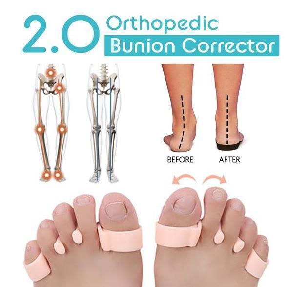 Silicone Toe Corrector & Separator(1 Pair)